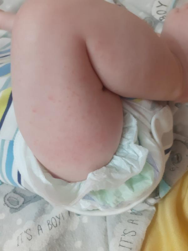 post image 4