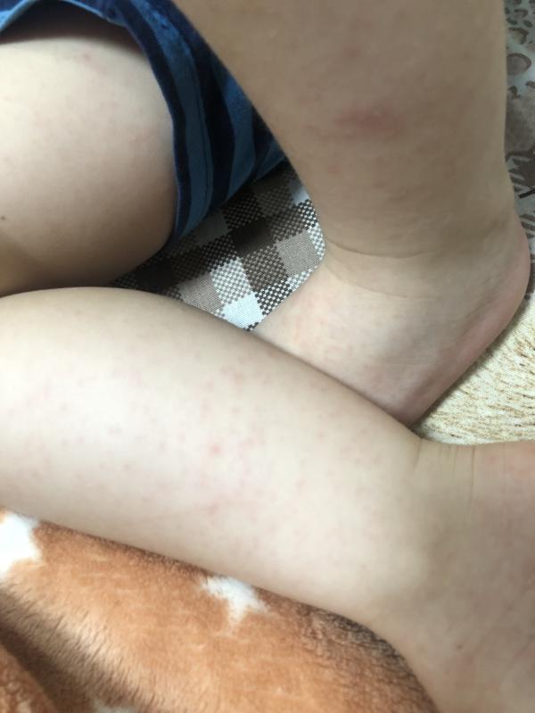 post image 4