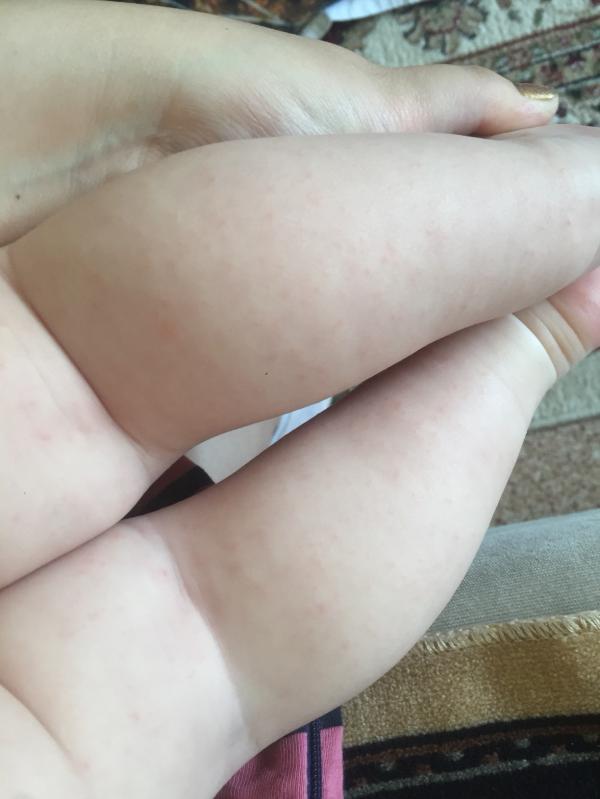 post image 4