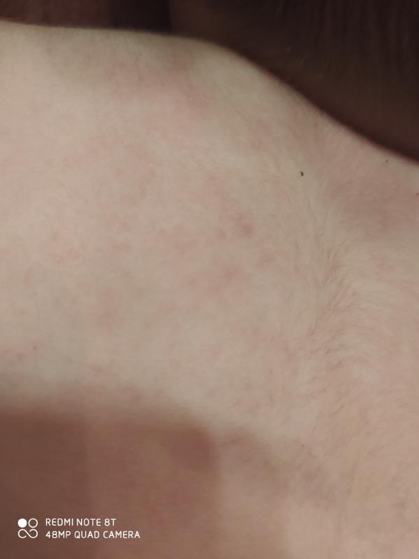 post image 3