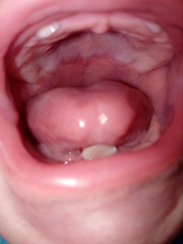post image 2