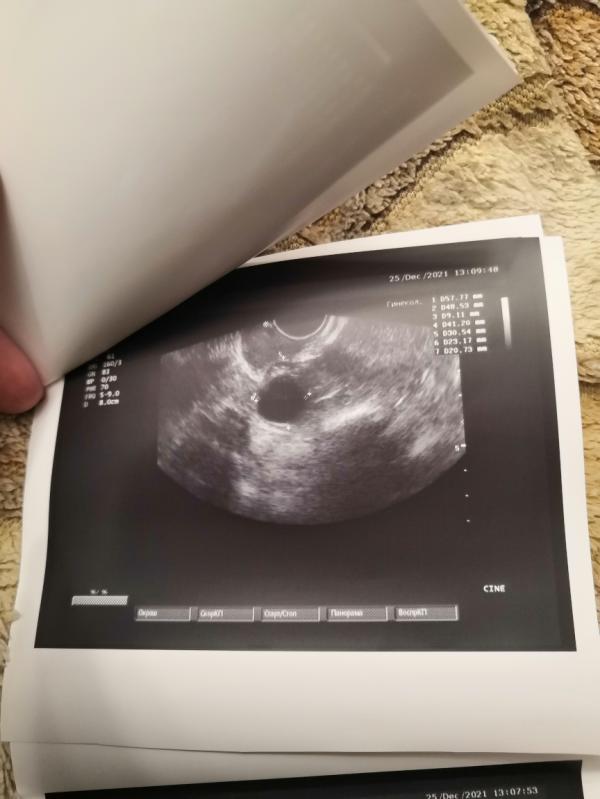 post image 4
