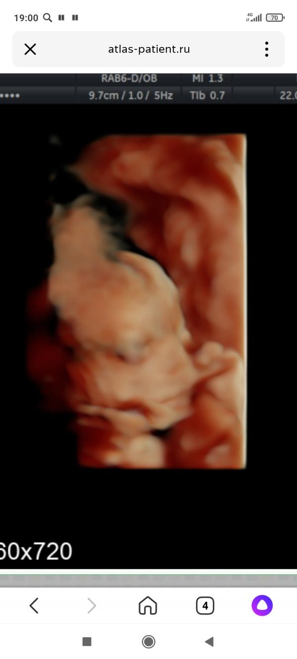post image 4