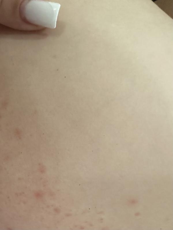post image 4