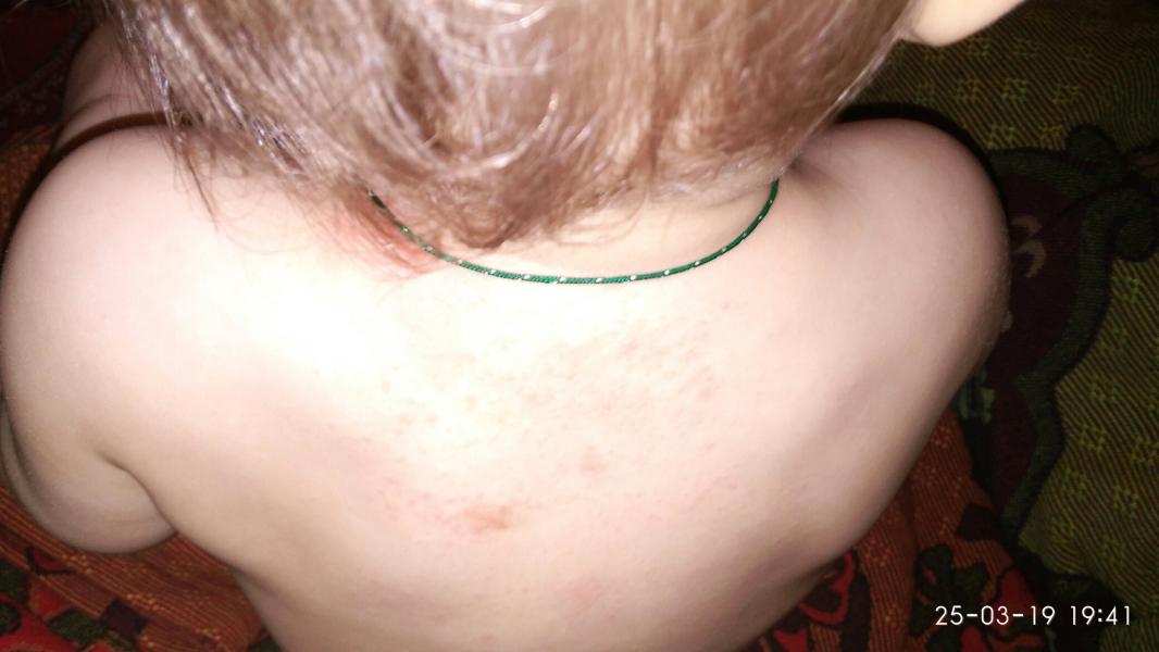post image 2