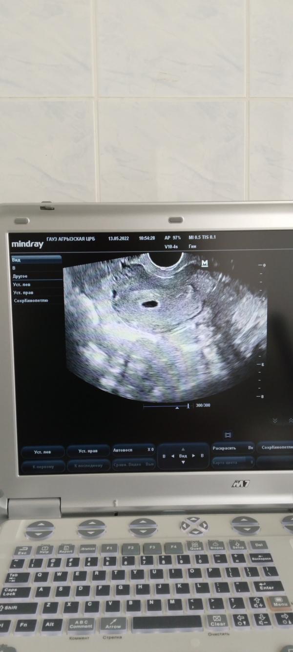 post image 4