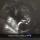 melly_17
