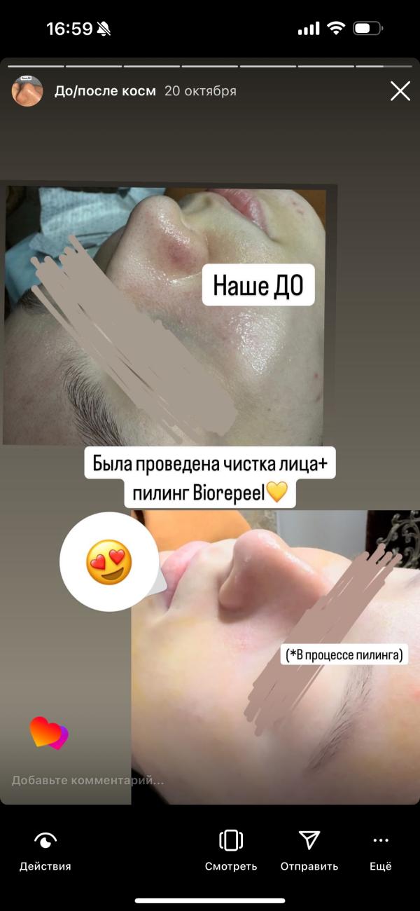 post image