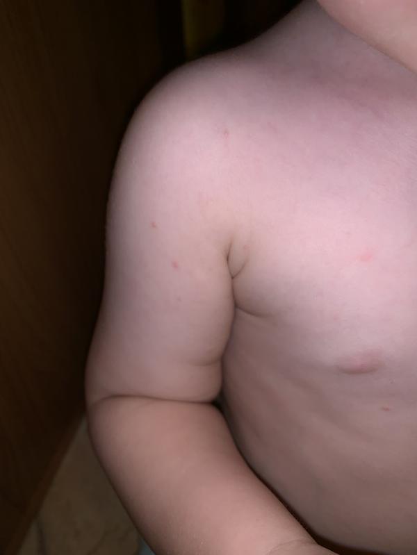 post image 2