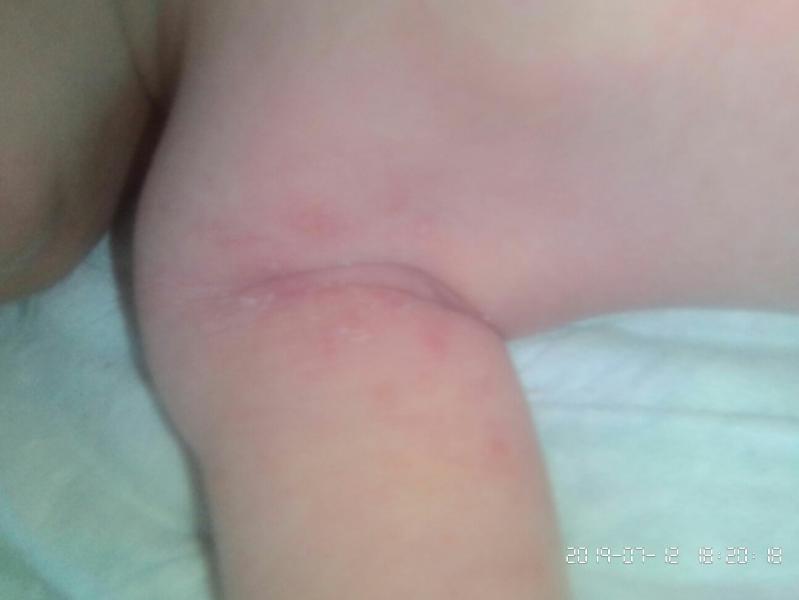 post image 3
