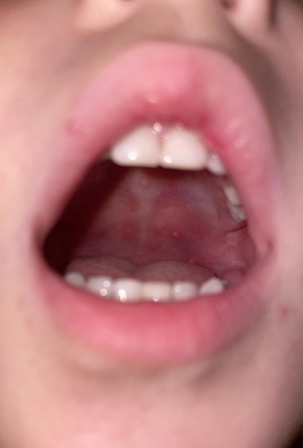 post image 2