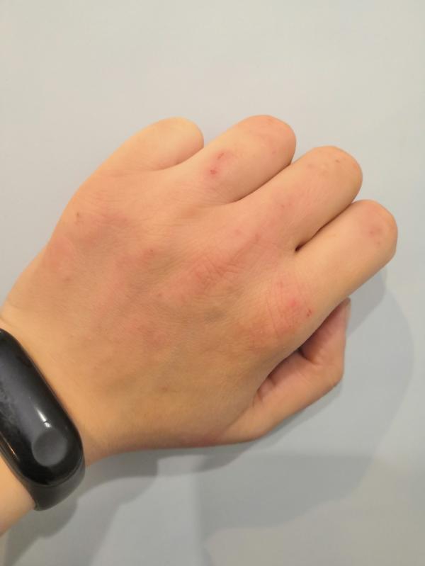 post image 2