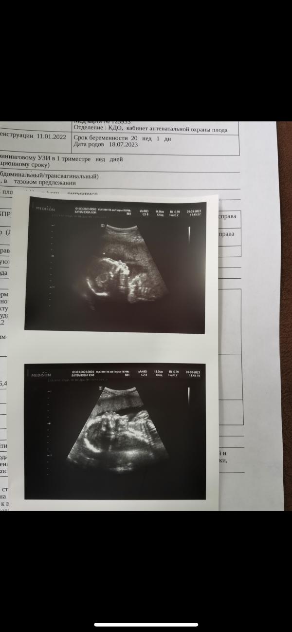 post image 5