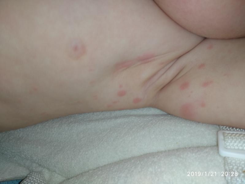 post image 2