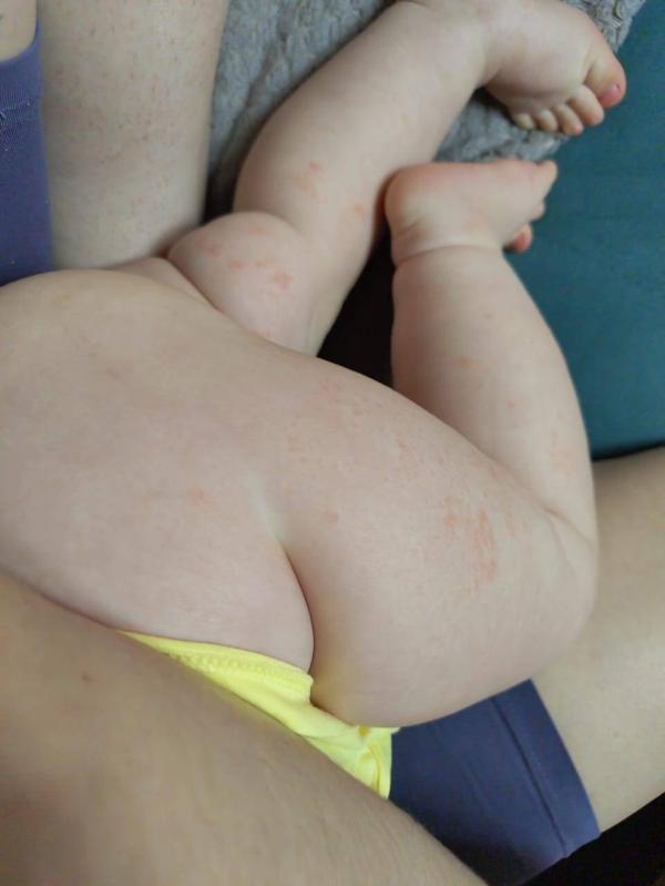 post image 4