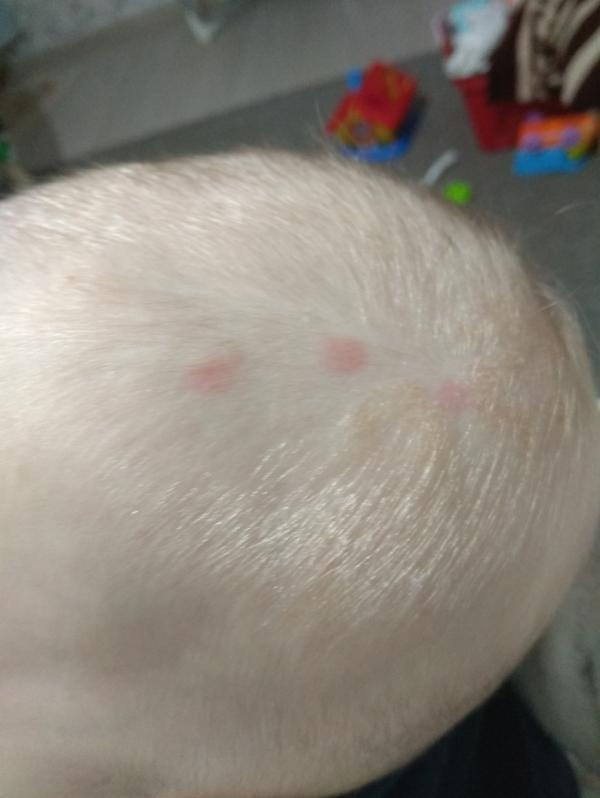 post image 2
