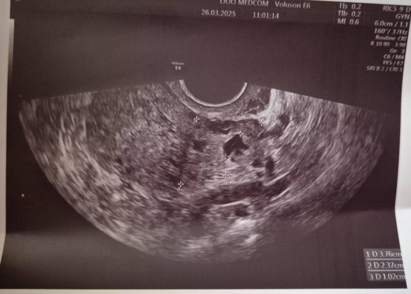 post image 4