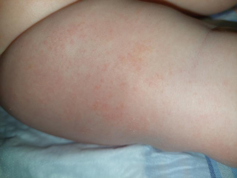 post image 4