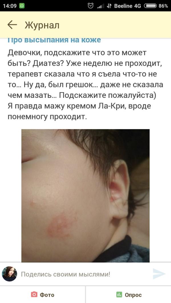 post image