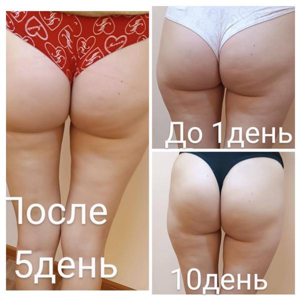 post image 5