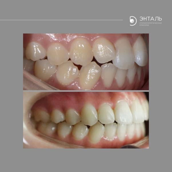 post image 4