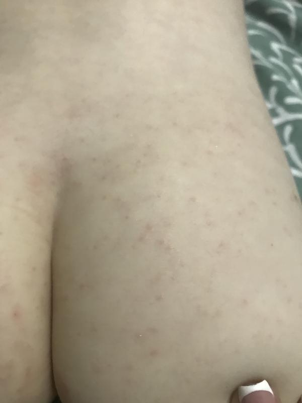 post image 4