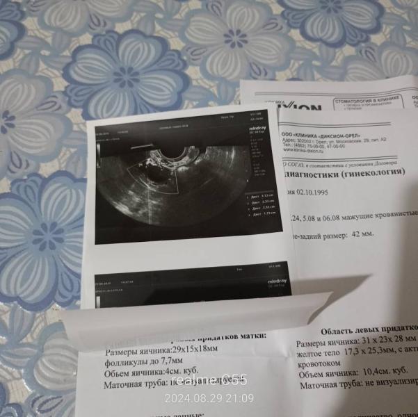 post image 3
