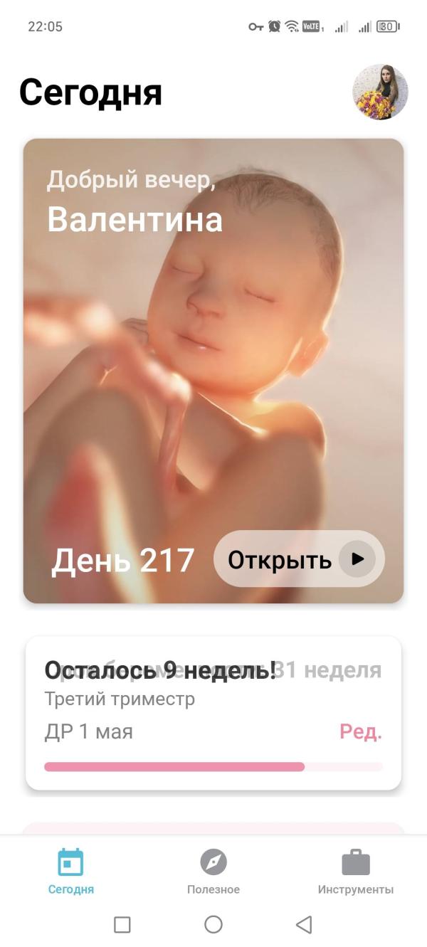 post image 4