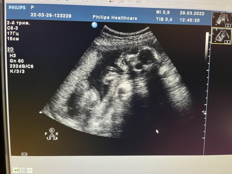 post image 4