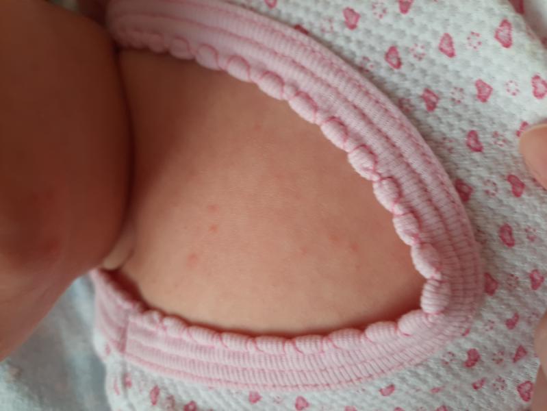 post image 4