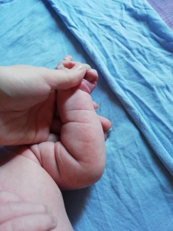 post image 1