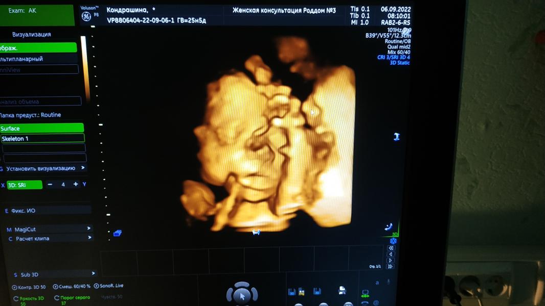 post image 4