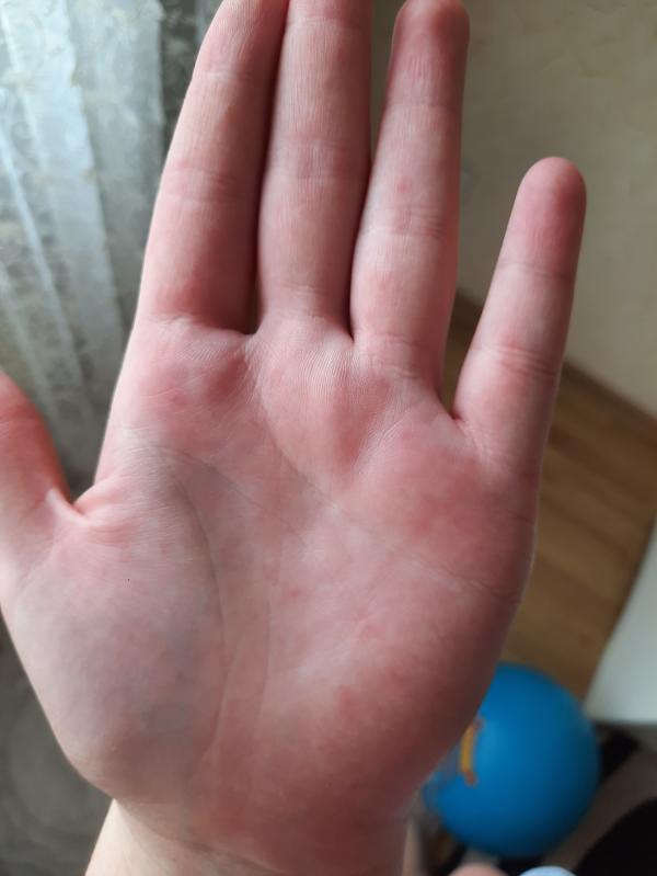 post image 5
