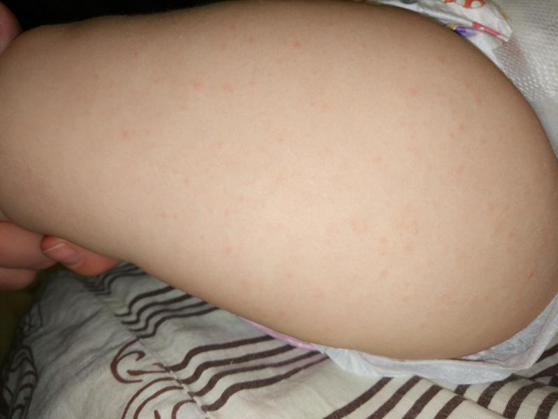 post image 4