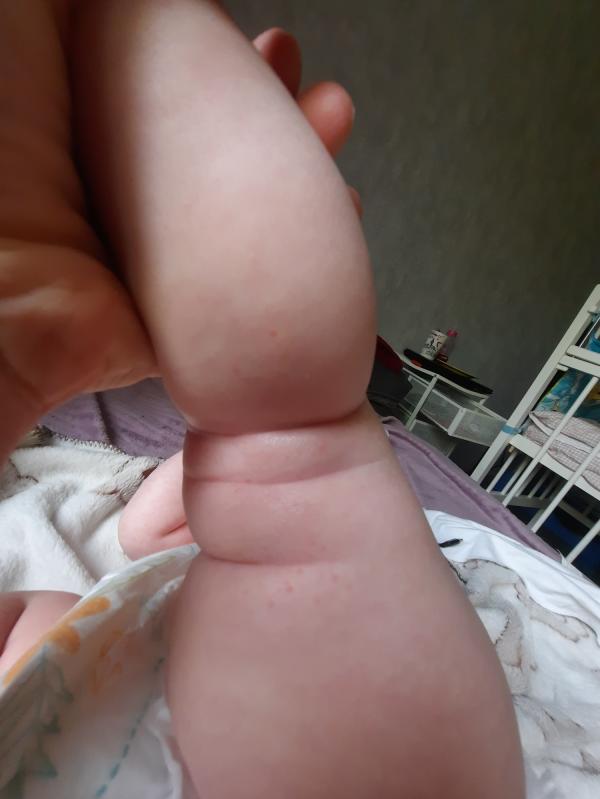 post image 4