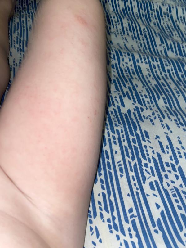 post image 4