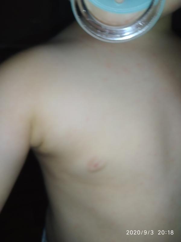 post image 2