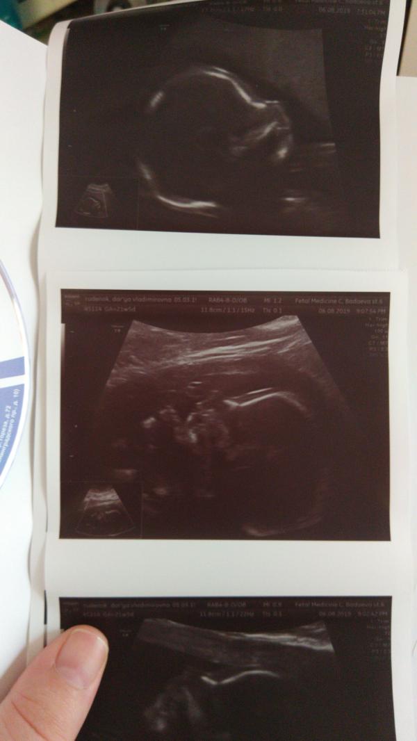 post image 5