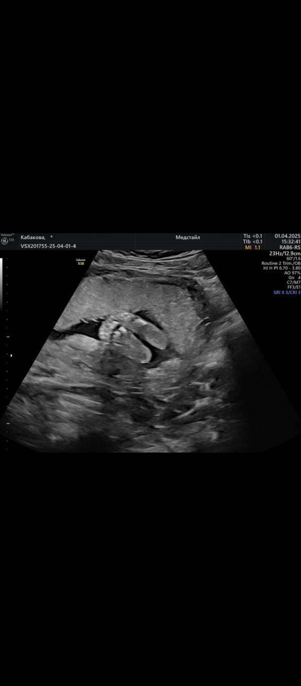 post image 4