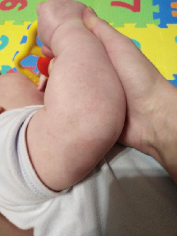 post image 2