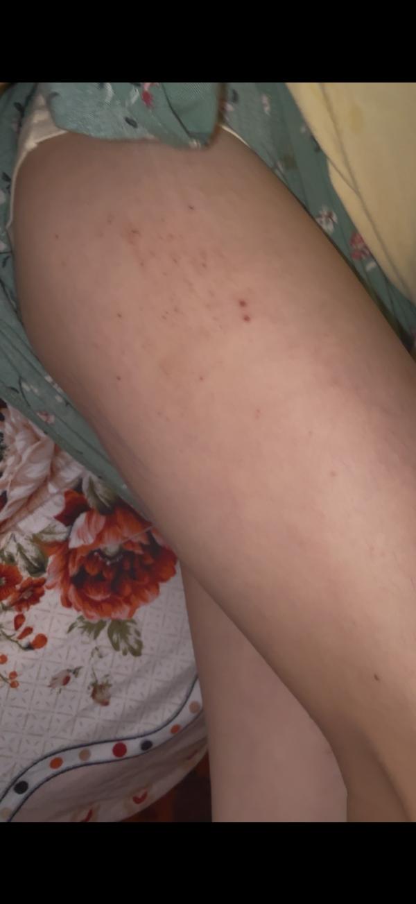post image 3