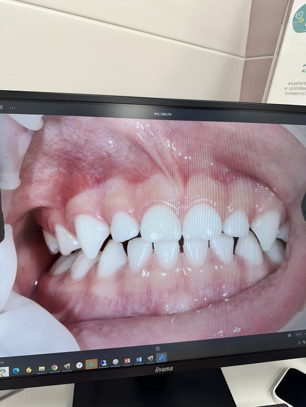 post image 4