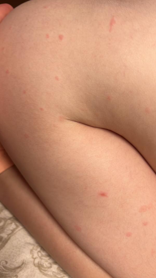 post image 2