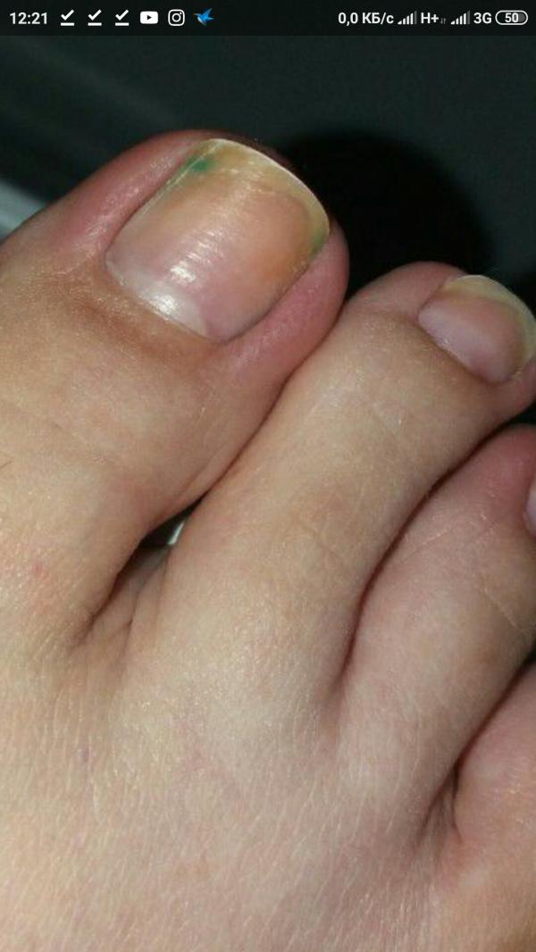 post image 5