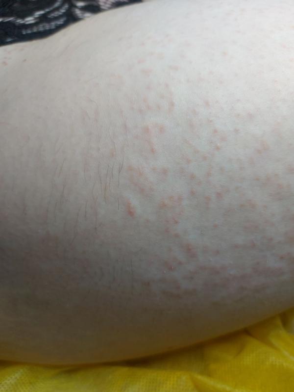 post image 5