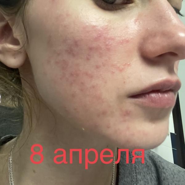 post image 4