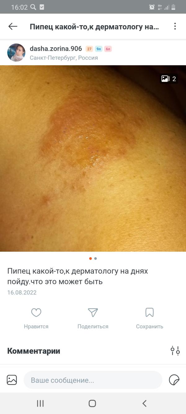 post image 1