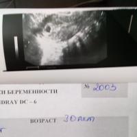 Алеся