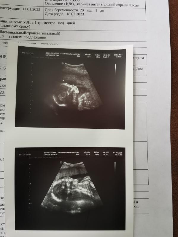 post image 3