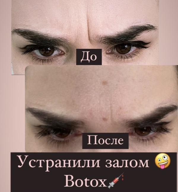 post image 4